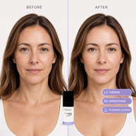 Before-and-after comparison of a woman's face with badges reading firmer, smoother and plumper-looking.