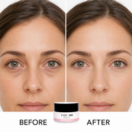 Before-and-after comparison of a woman's under-eye area showing reduced dark circles, with the Eyeconik jar below.