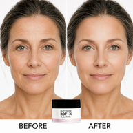 Before-and-after comparison of a woman's face with the Intense Botox Cream jar at the bottom centre.
