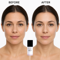 Before-and-after comparison showing skin texture improvement, with the Intense Botox Serum bottle centered at the bottom.