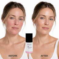 Before-and-after comparison of a woman's face with the Oil Solution Serum bottle centered between the panels.