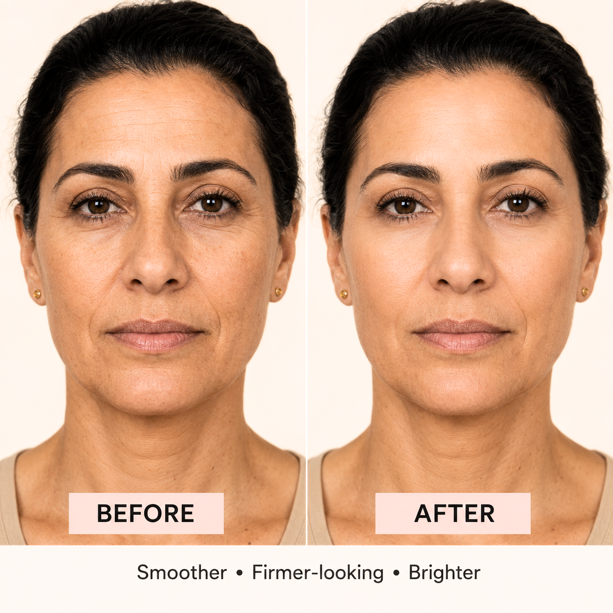 Before-and-after comparison of a woman's face showing skincare results on a light beige background.