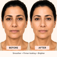 Before-and-after comparison of a woman's face showing skincare results on a light beige background.